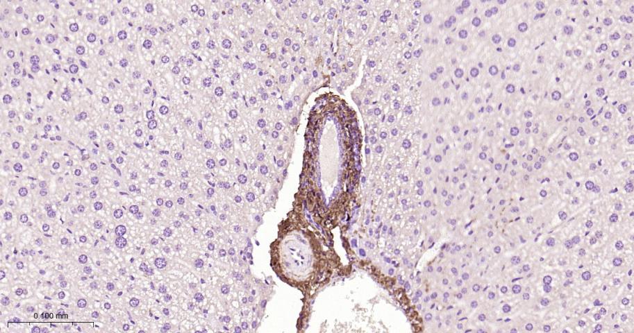 I型胶原蛋白/胶原蛋白1/1型胶原蛋白/I型胶原a1抗体