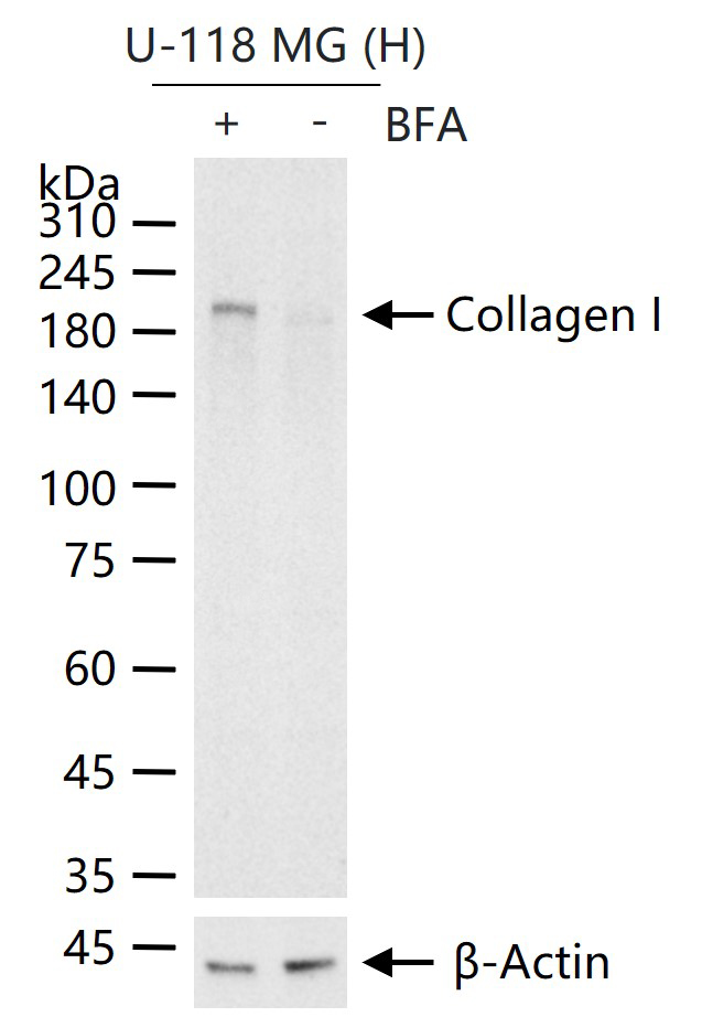 I型胶原蛋白/胶原蛋白1/1型胶原蛋白/I型胶原a1抗体