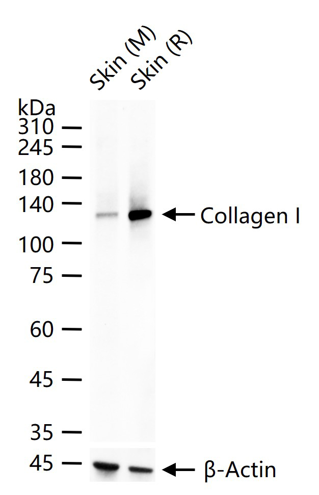 I型胶原蛋白/胶原蛋白1/1型胶原蛋白/I型胶原a1抗体