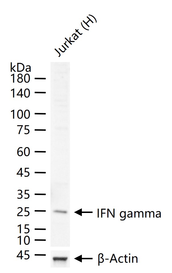 IFN gamma Rabbit pAb (一抗) - WB,Flow-Cyt,ICC/IF | Bioss