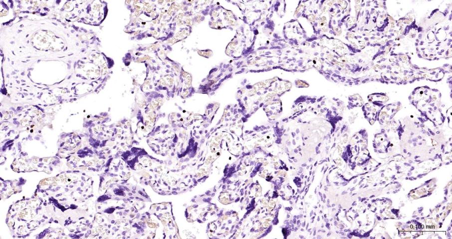乳铁蛋白重组兔单抗