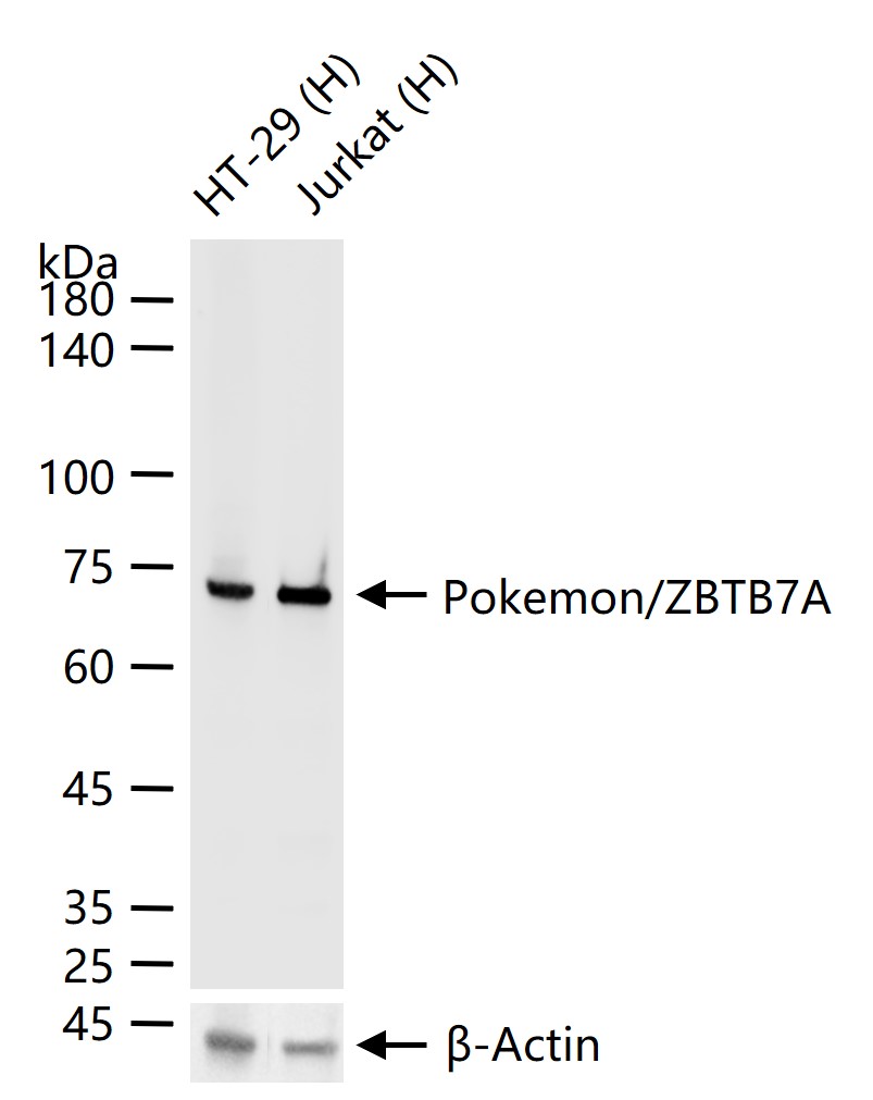 扑克蒙蛋白重组兔单抗