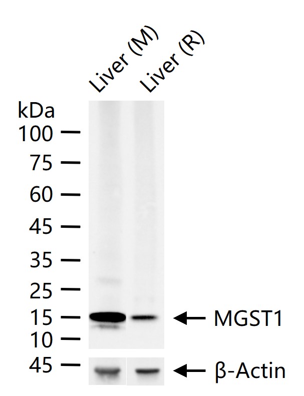 微粒体谷胱甘肽S转移酶1重组兔单抗