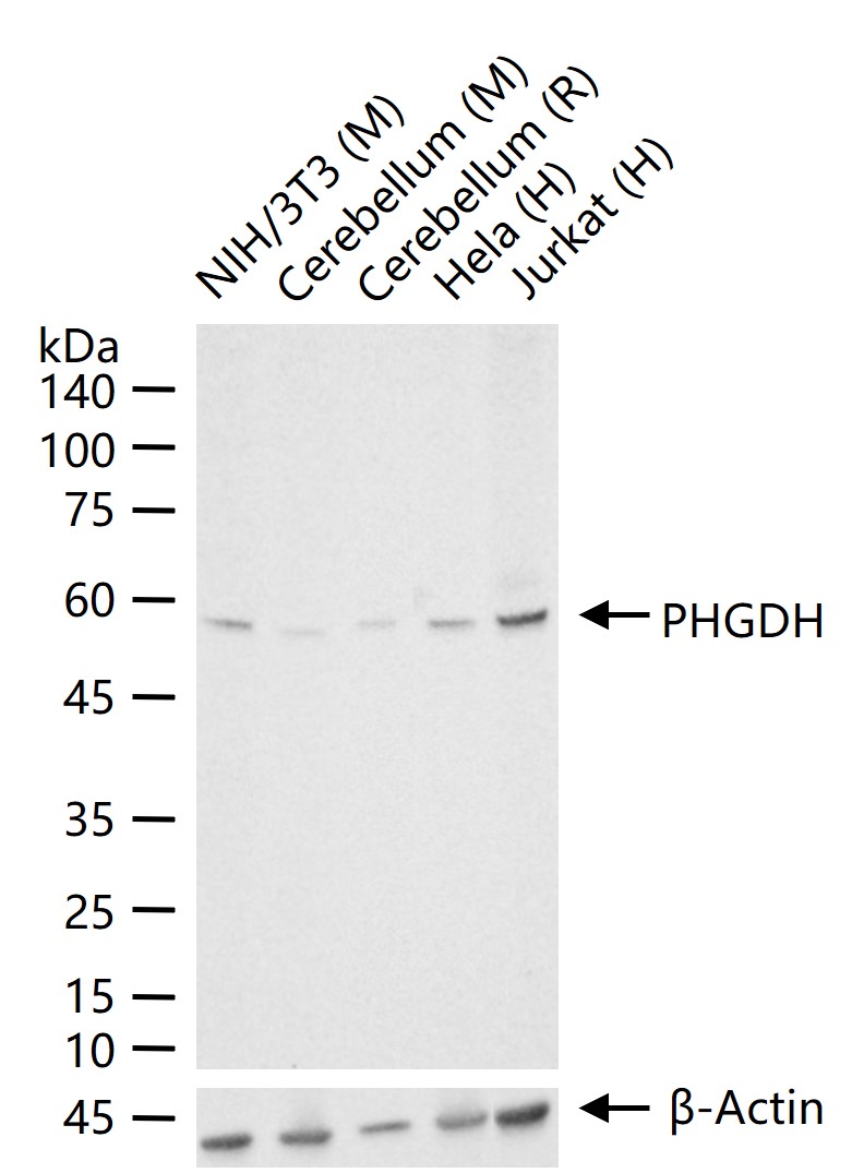PHGDH Recombinant Mouse mAb (一抗) - WB,IHC-P,IHC-F,IF | Bioss