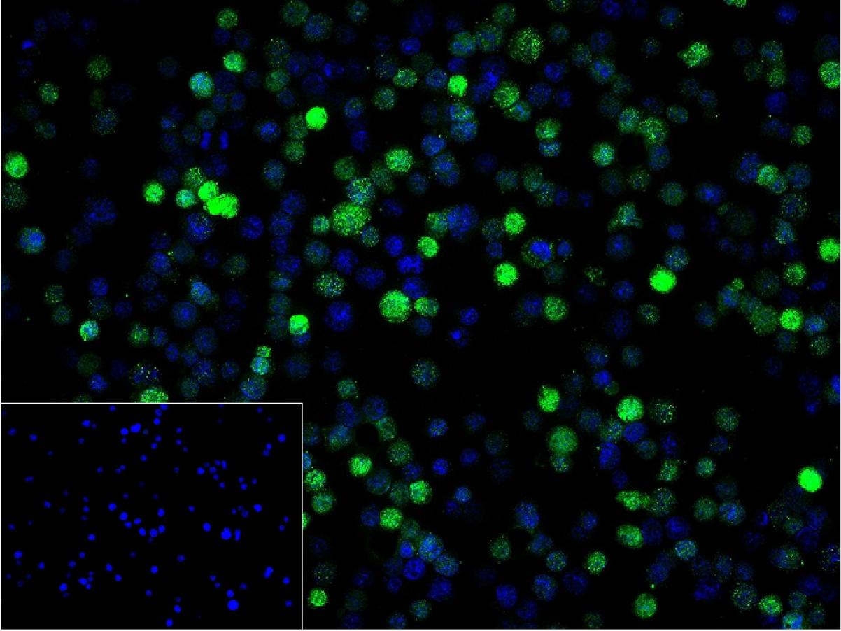 γ-干扰素/γ-IFN重组兔单抗