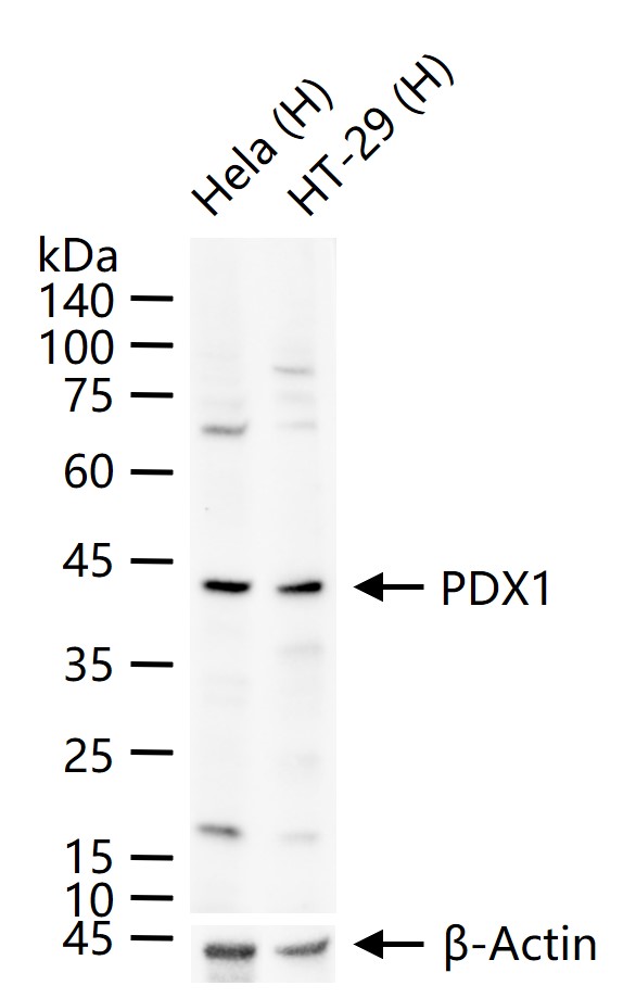 胰岛素促进因子重组兔单抗