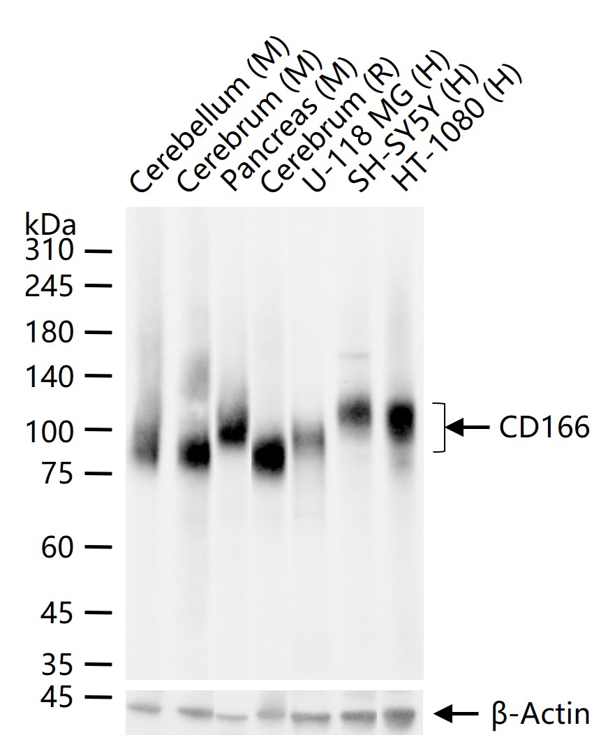 活化白细胞粘附分子重组兔单抗