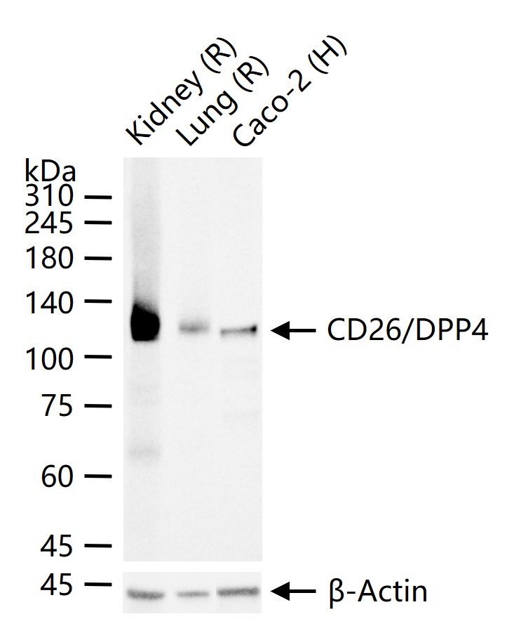 CD26D/PP4抗体