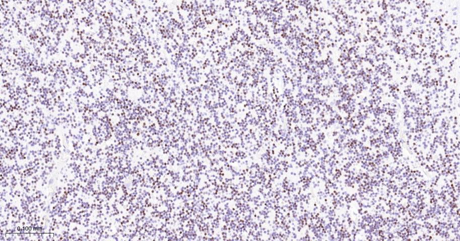 神经元核抗原重组兔单抗