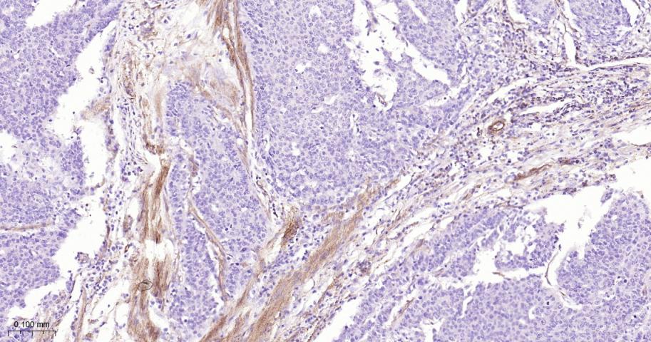 基质金属蛋白酶-1重组兔单抗