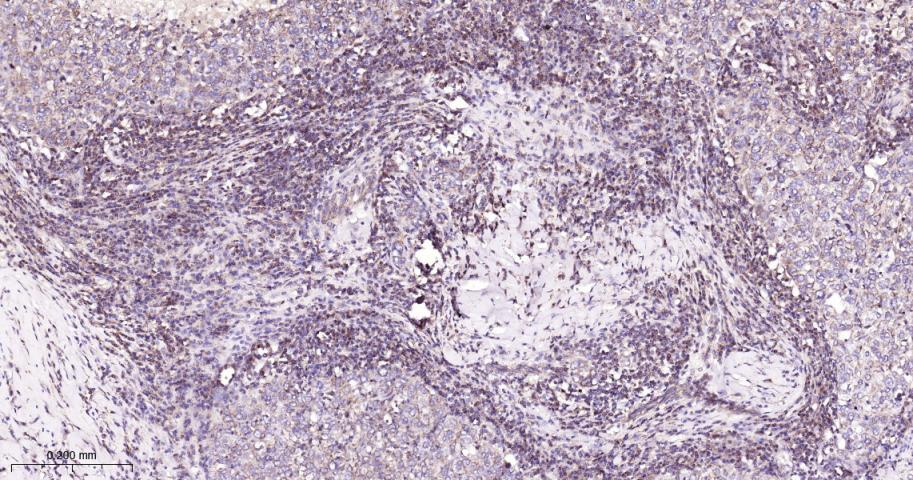 干细胞生长因子重组兔单抗