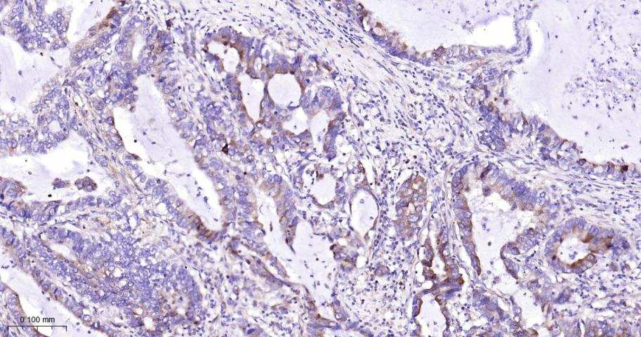 基质金属蛋白酶-1重组兔单抗