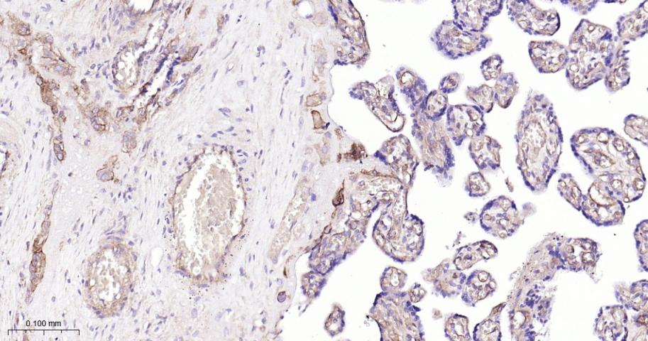 基质金属蛋白酶-1重组兔单抗