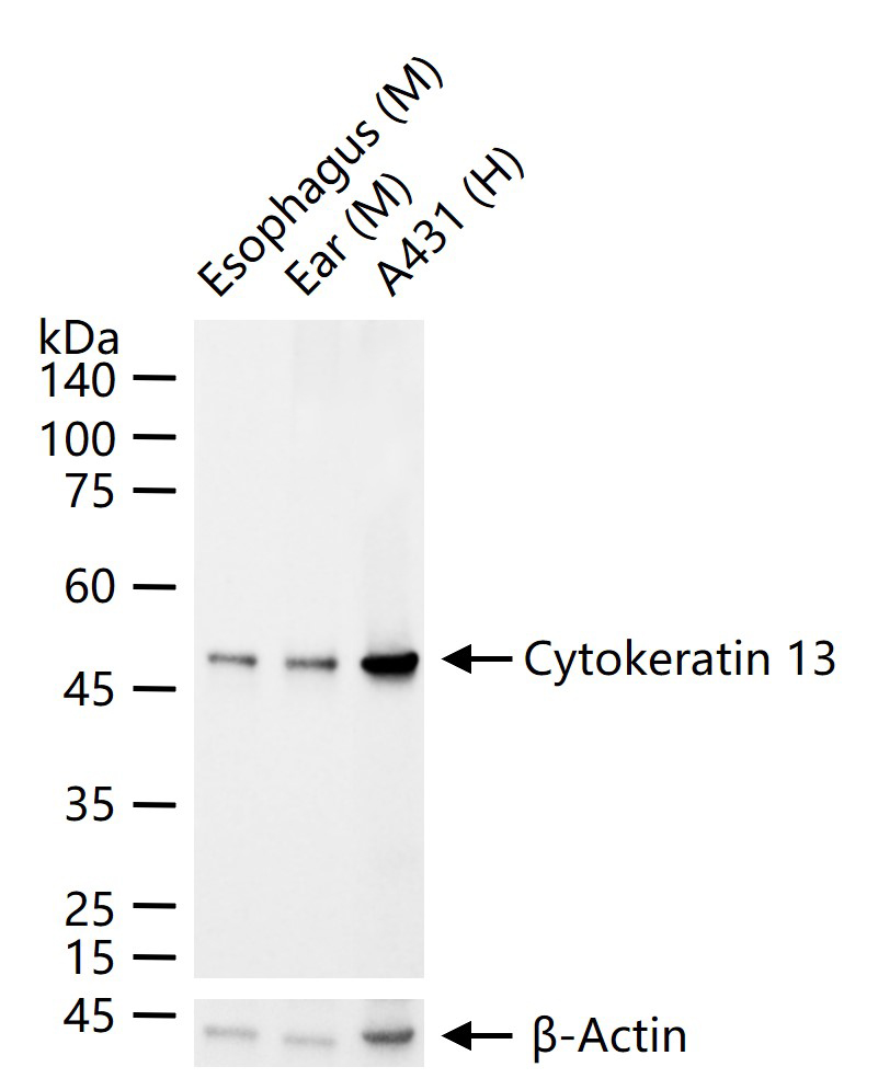 细胞角蛋白13重组兔单抗