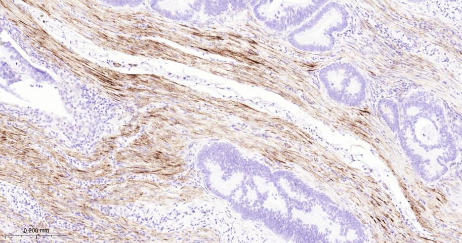 肌球蛋白调节多肽9重组兔单抗