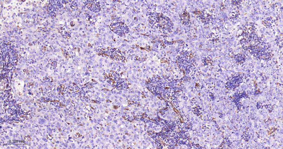 基质金属蛋白酶-1重组兔单抗
