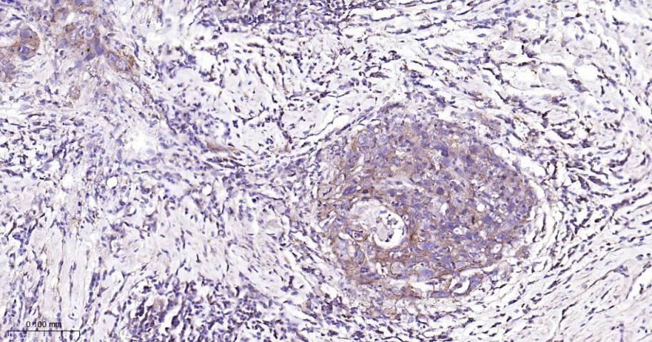 基质金属蛋白酶-1重组兔单抗