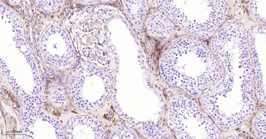 基质金属蛋白酶-1重组兔单抗