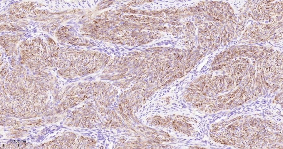 肌球蛋白调节多肽9重组兔单抗