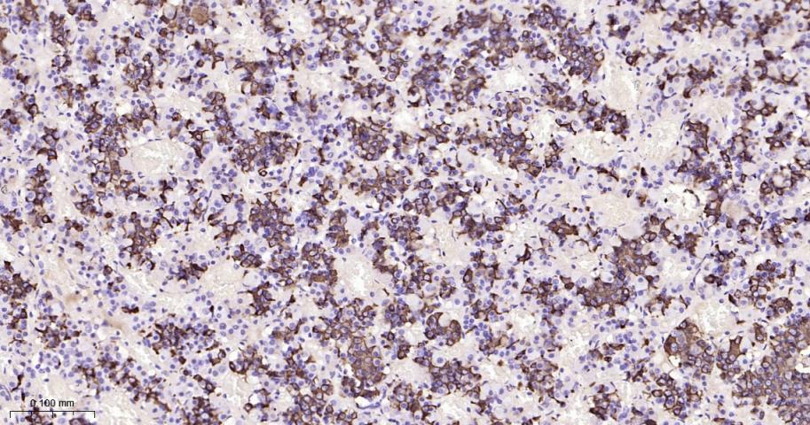 泌乳素重组兔单抗