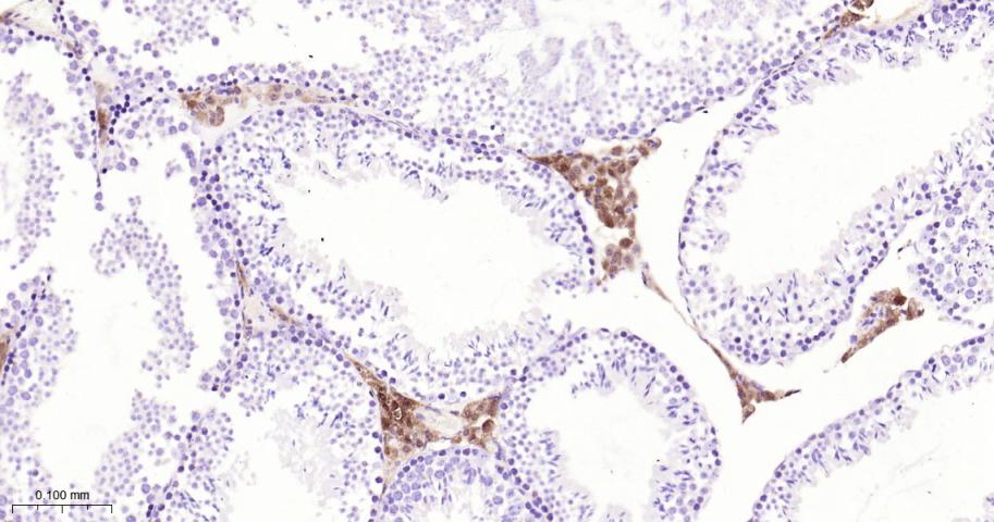 基质金属蛋白酶-1重组兔单抗