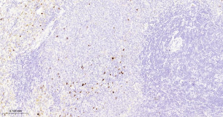 基质金属蛋白酶-9重组兔单抗