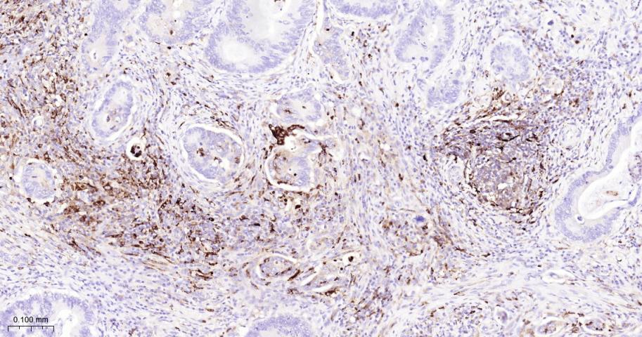 基质金属蛋白酶-9重组兔单抗
