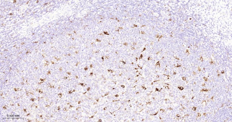 基质金属蛋白酶-9重组兔单抗