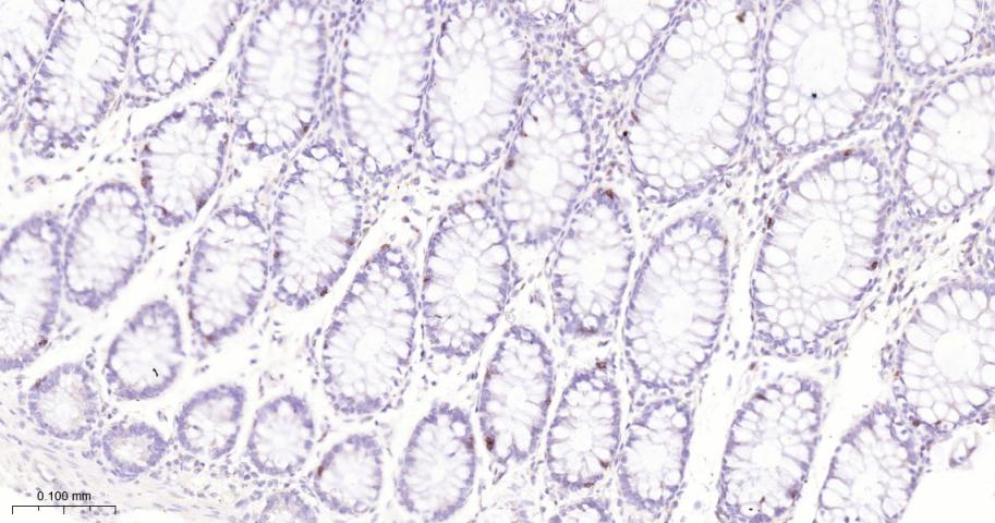 整合素αE重组兔单抗
