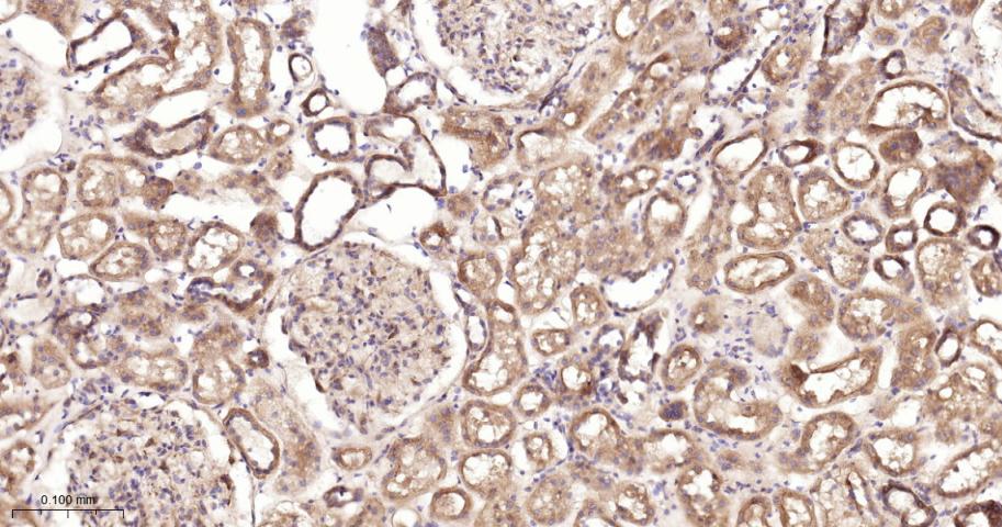 蛋白激酶B重组兔单抗