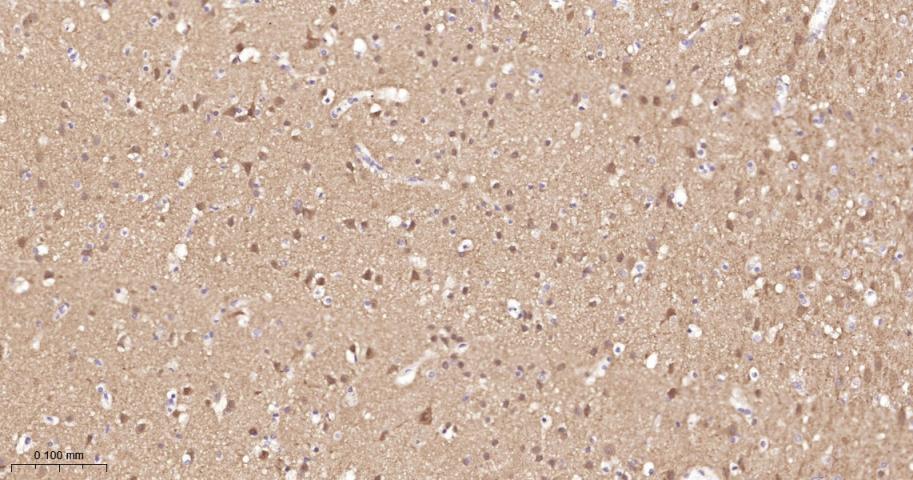 蛋白激酶B重组兔单抗