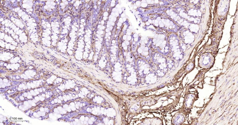 Ⅲ型胶原蛋白/胶原蛋白3/3型胶原蛋白/III型胶原抗体-bs-0549R