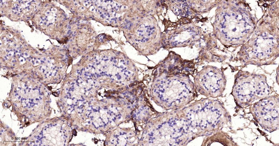 Ⅲ型胶原蛋白重组兔单抗
