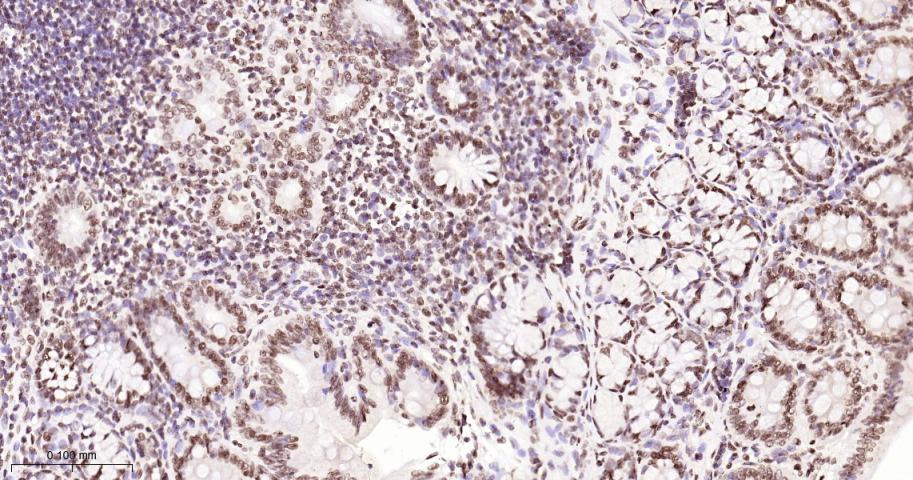 单甲基化组蛋白H3K18重组兔单抗