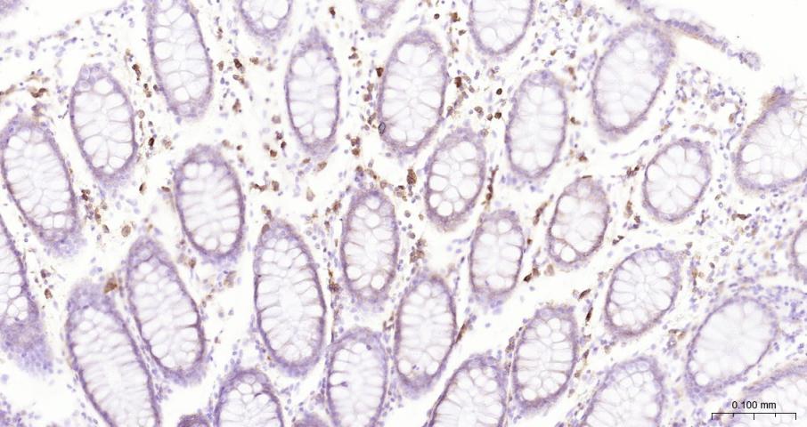 多配体蛋白聚糖1（CD138）单克隆抗体-bsm-43670M