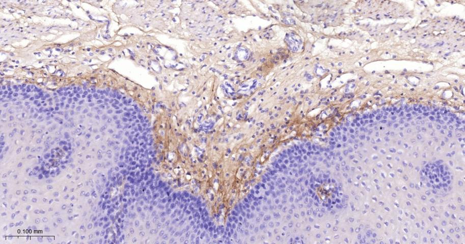 Ⅲ型胶原蛋白/胶原蛋白3/3型胶原蛋白/III型胶原抗体-bs-0549R