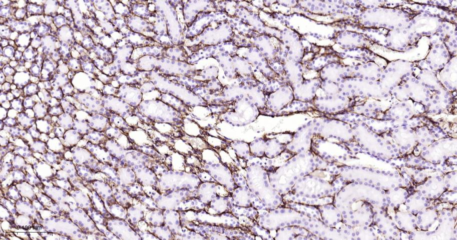 Ⅲ型胶原蛋白/胶原蛋白3/3型胶原蛋白/III型胶原抗体-bs-0549R