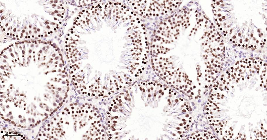 单甲基化组蛋白H3K18重组兔单抗