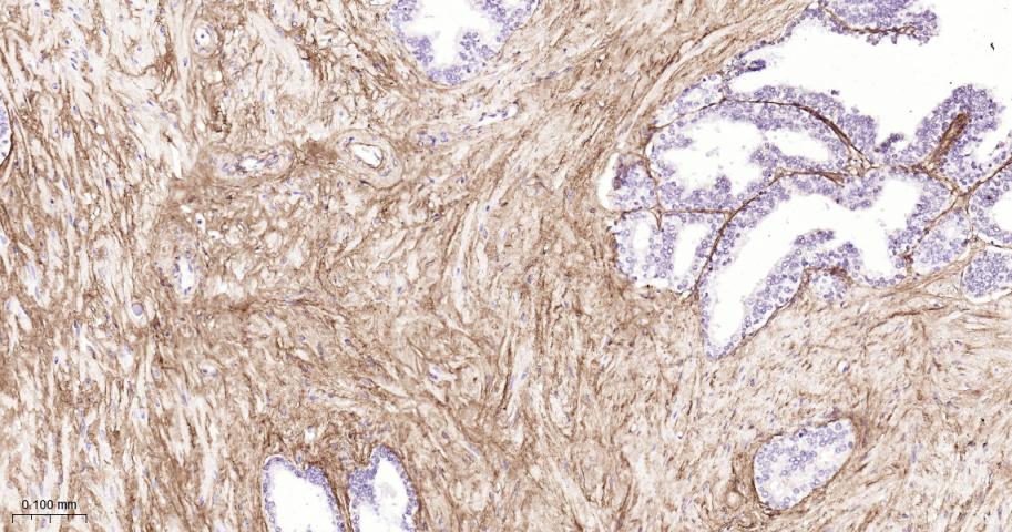 Ⅲ型胶原蛋白重组兔单抗