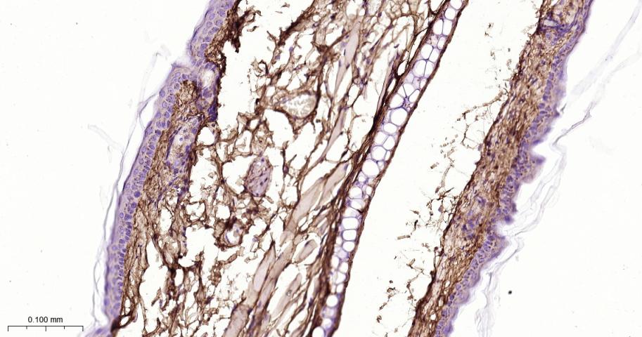 Ⅲ型胶原蛋白/胶原蛋白3/3型胶原蛋白/III型胶原抗体-bs-0549R