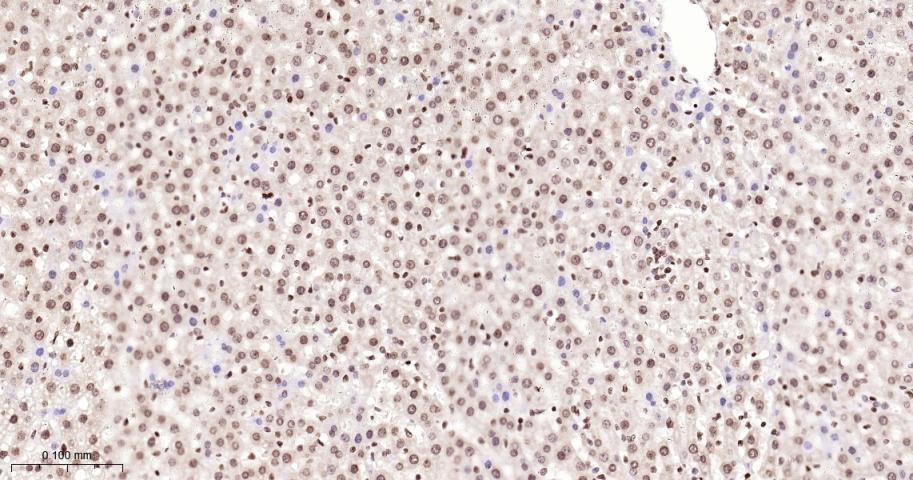 单甲基化组蛋白H3K18重组兔单抗