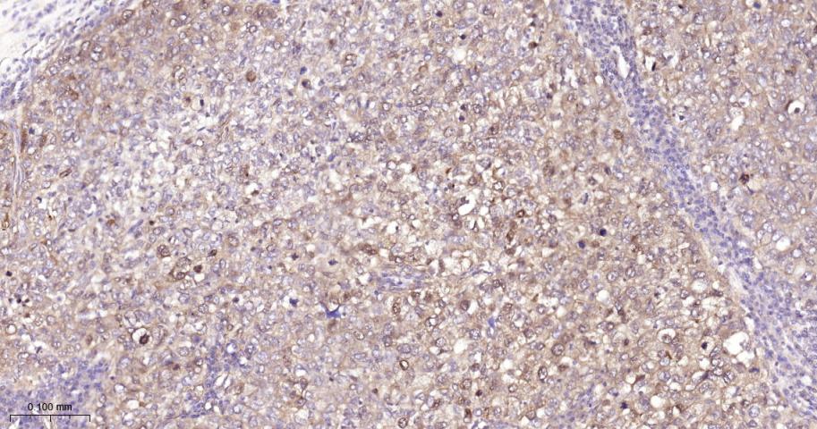 蛋白激酶B重组兔单抗