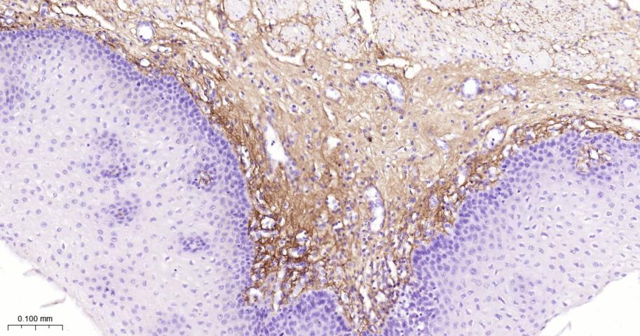 III型胶原单克隆抗体-bsm-33129M