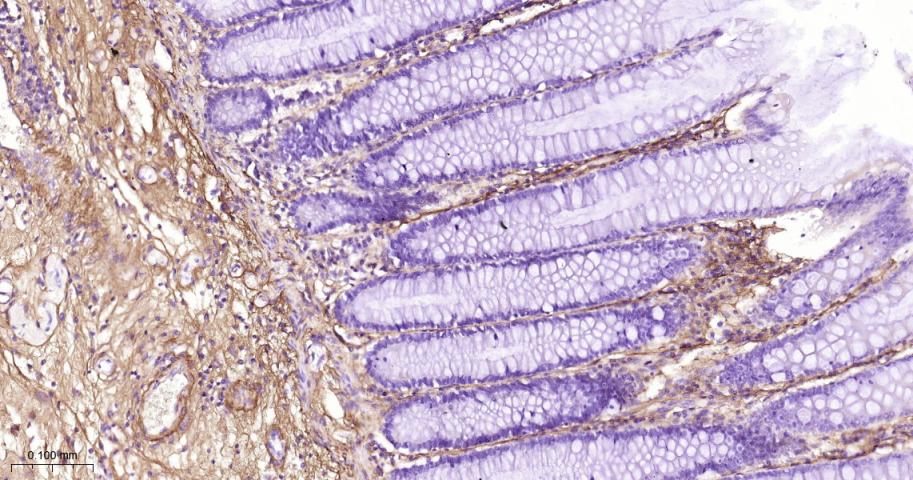 III型胶原单克隆抗体-bsm-33129M