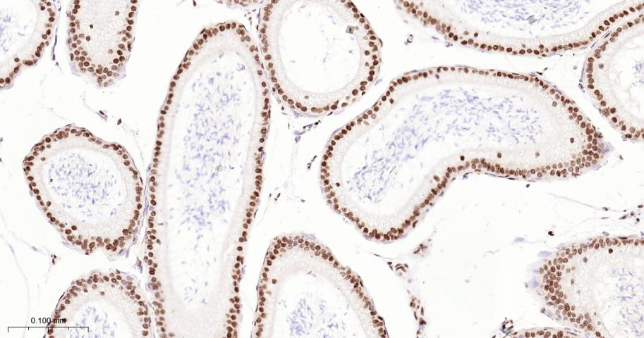 单甲基化组蛋白H3K18重组兔单抗