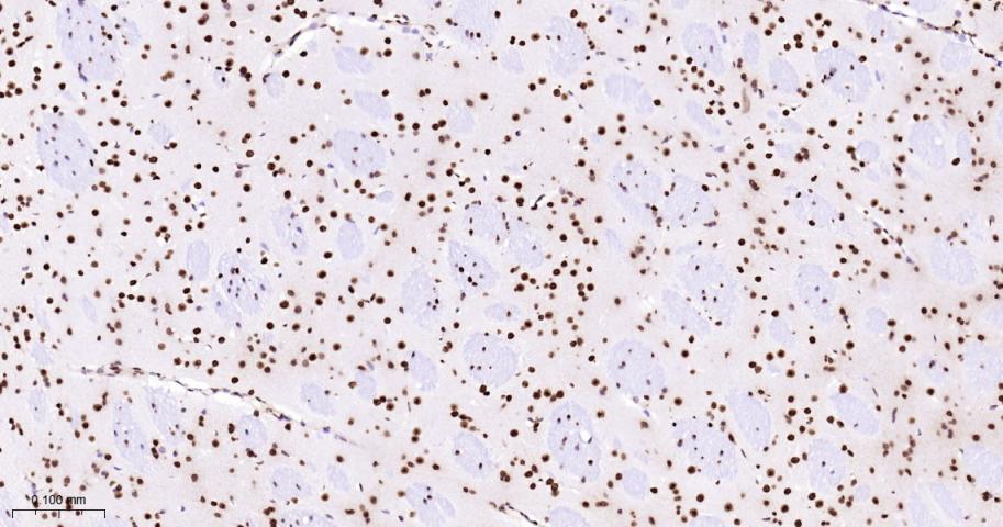 单甲基化组蛋白H3K18重组兔单抗
