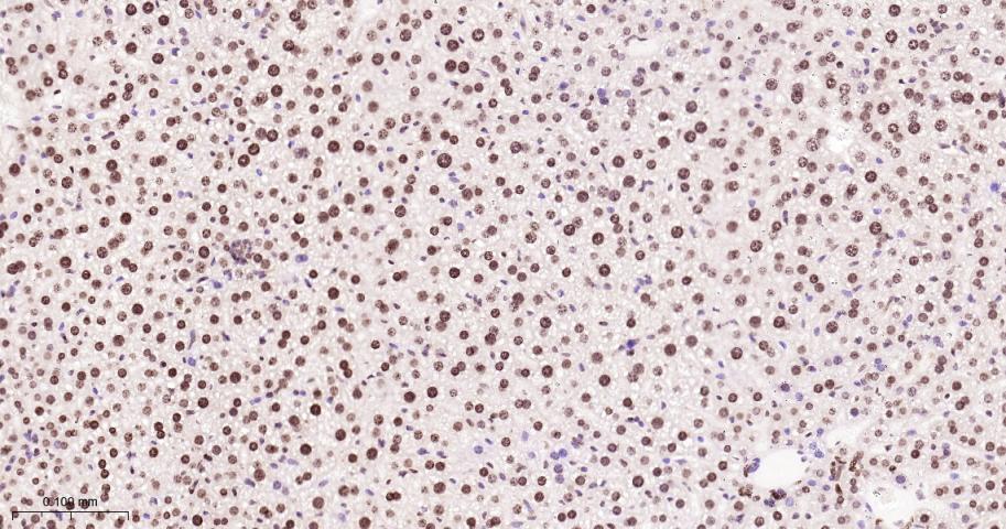 单甲基化组蛋白H3K18重组兔单抗
