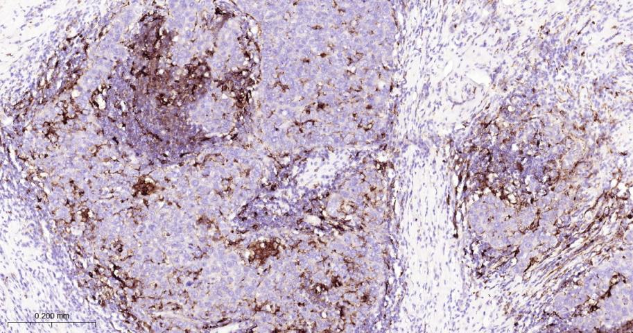 基质金属蛋白酶-9重组兔单抗