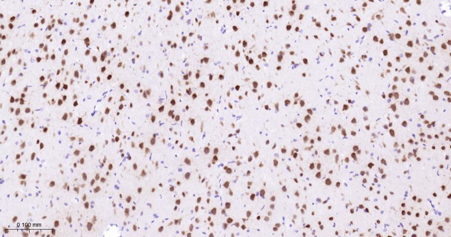 神经元核抗原重组兔单抗