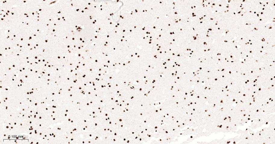 单甲基化组蛋白H3K18重组兔单抗